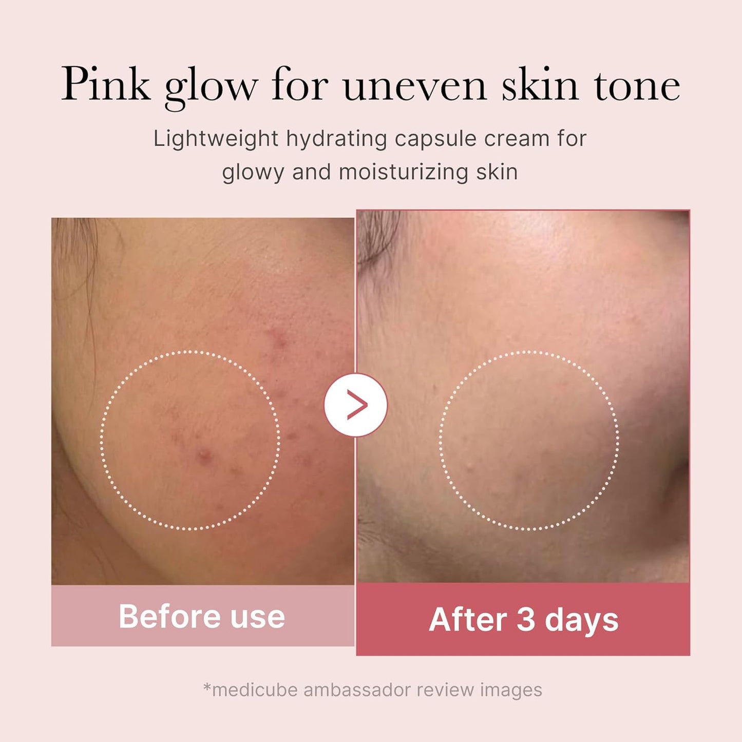 medicube Capsule Cream with Salmon DNA PDRN Pink Collagen | Lightweight Moisturizing Cream with PDRN, Niacinamide for Uneven Skin Tone and Texture, Glow hydration