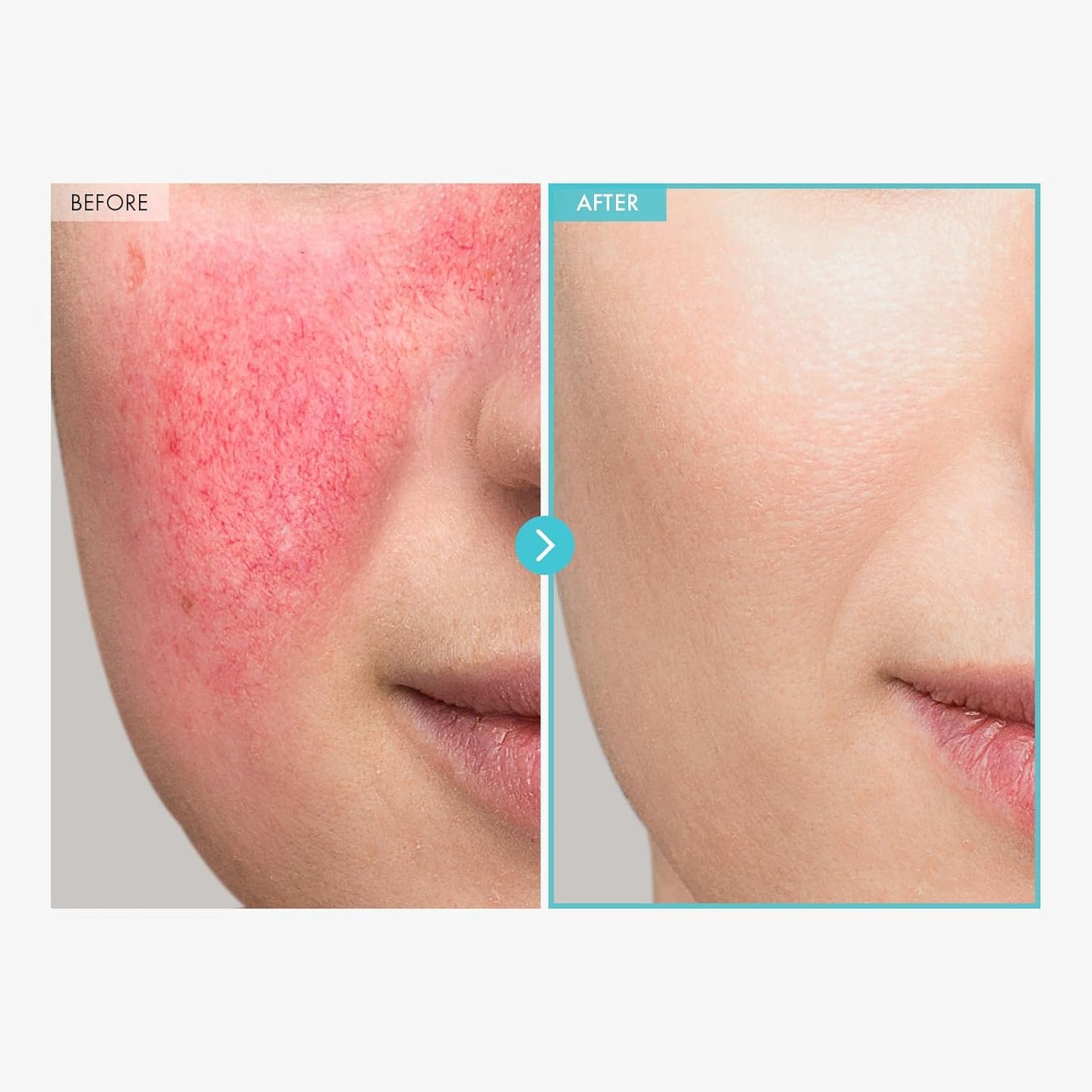 TOSOWOONG Cica Clinic Madecare Ointment 50g