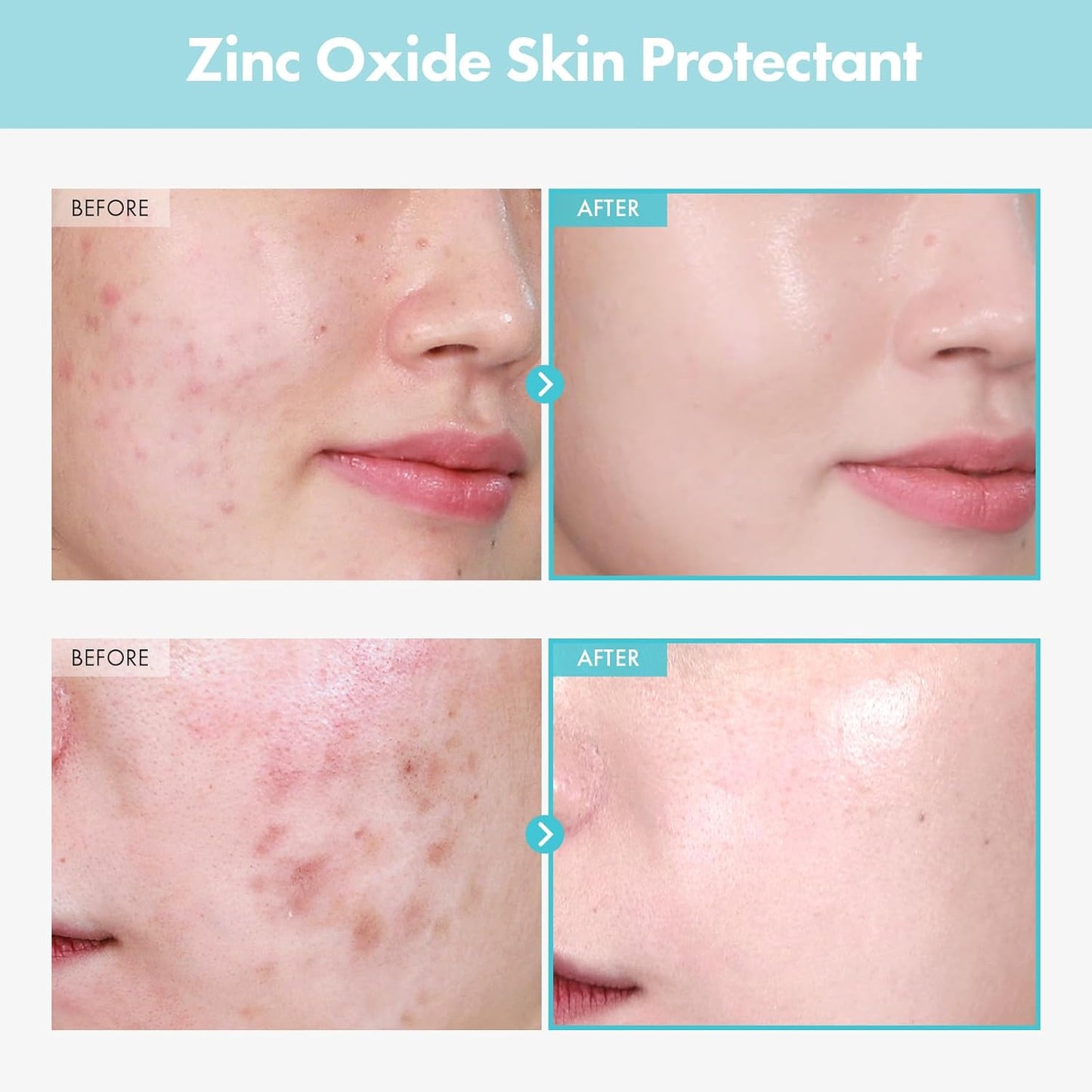 TOSOWOONG Cica Clinic Madecare Ointment 50g