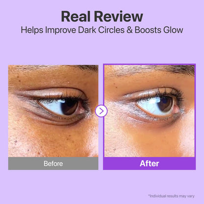 Numbuzin No.9 NAD Retinol Volumetox Eye Cream 10ml