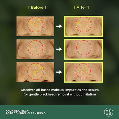 ANUA HEARTLEAF PORE CONTROL CLEANSING OIL 20ml