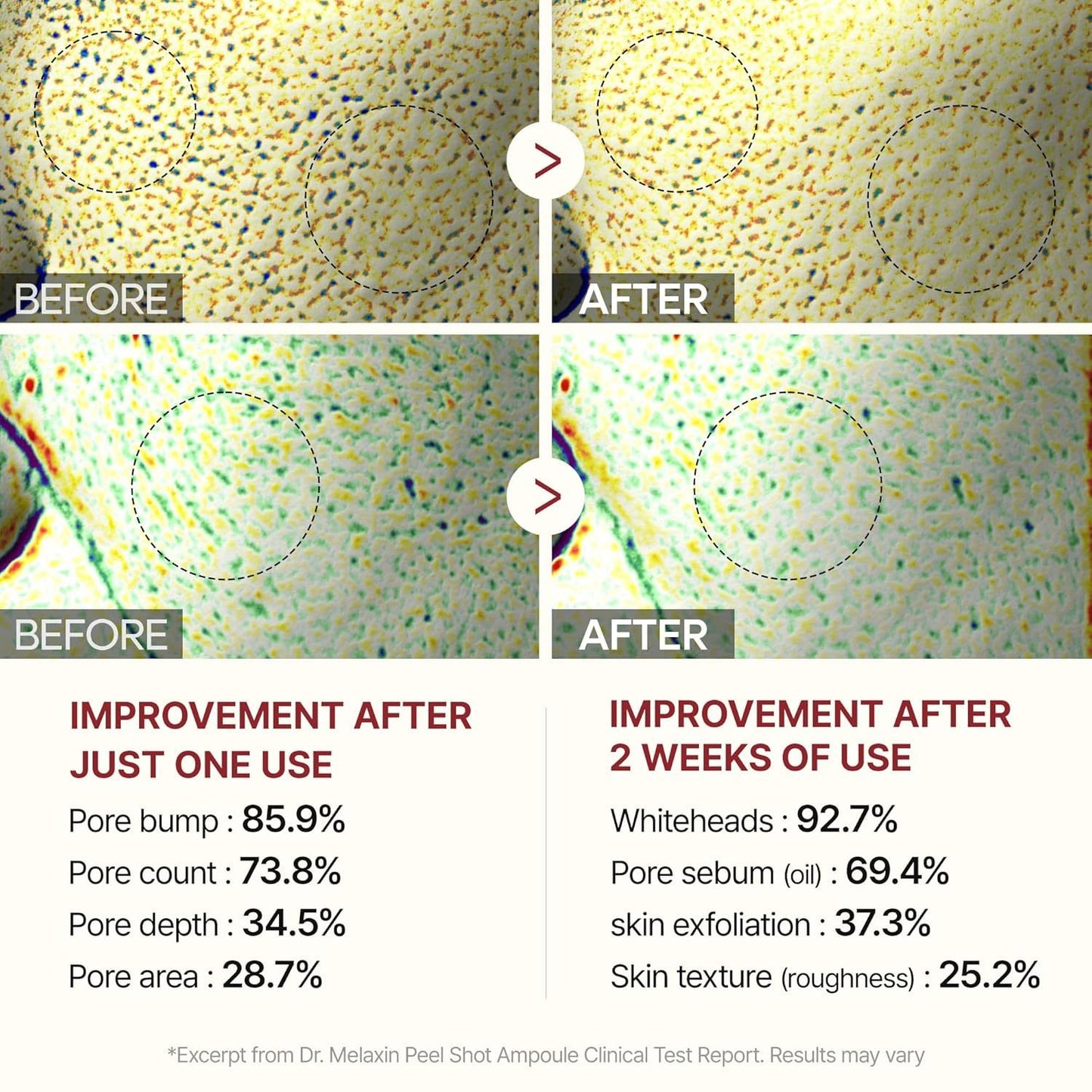 [Dr.Melaxin Official] Peel Shot Glow Rice Ampoule Duo - Serums for Brightening, Exfoliating, and Moisturizing - Suitable for All Skin Types