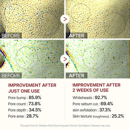 [Dr.Melaxin Official] Peel Shot Glow Rice Ampoule Duo - Serums for Brightening, Exfoliating, and Moisturizing - Suitable for All Skin Types
